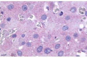 Anti-PTGFR antibody  ABIN1049262 IHC staining of human ovary. (PTGFR 抗体  (Cytoplasmic Domain))