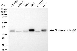 anti-Ribosomal Protein S3 (RPS3) antibody