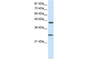 WB Suggested Anti-HES6 Antibody Titration:  1. (HES6 抗体  (C-Term))