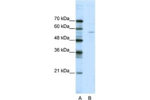 Western Blotting (WB) image for anti-ELK1, Member of ETS Oncogene Family (ELK1) antibody (ABIN2461748) (ELK1 抗体)