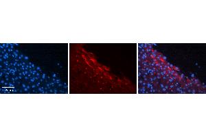 Rabbit Anti-CTAGE5 Antibody   Formalin Fixed Paraffin Embedded Tissue: Human Liver Tissue Observed Staining: Plasma membrane in hepatocytes Primary Antibody Concentration: 1:100 Other Working Concentrations: N/A Secondary Antibody: Donkey anti-Rabbit-Cy3 Secondary Antibody Concentration: 1:200 Magnification: 20X Exposure Time: 0. (MIA2 抗体  (N-Term))