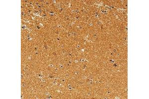 IHC analysis of Syntaphilin/SNPH using anti-Syntaphilin/SNPH antibody (ABIN7601724). (Syntaphilin 抗体  (AA 43-482))