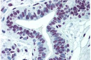 Human Breast: Formalin-Fixed, Paraffin-Embedded (FFPE) (CDKL1 抗体  (AA 259-358))