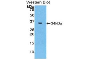 Western Blotting (WB) image for anti-Matrix Metallopeptidase 7 (Matrilysin, Uterine) (MMP7) (AA 1-264) antibody (ABIN1859856) (MMP7 抗体  (AA 1-264))