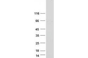 Western Blotting (WB) image for POC5 Centriolar Protein Homolog (POC5) (Transcript Variant 2) protein (Myc-DYKDDDDK Tag) (ABIN2729270)