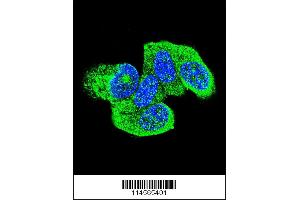 Confocal immunofluorescent analysis of HRAS Antibody with MCF-7 cell followed by Alexa Fluor 488-conjugated goat anti-rabbit lgG (green). (HRAS 抗体  (C-Term))
