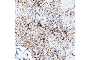 Immunohistochemistry (IHC) image for anti-Glial Fibrillary Acidic Protein (GFAP) antibody (ABIN7267389)