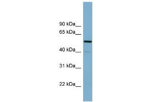 WB Suggested Anti-CDK5RAP1 Antibody Titration: 0. (CDK5RAP1 抗体  (N-Term))