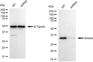 Western blotting analysis using Emerin antibody (ABIN7798436).