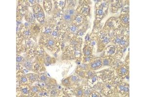 Immunohistochemistry of paraffin-embedded Mouse liver using CYP2C18 Polyclonal Antibody at dilution of 1:100 (40x lens). (CYP2C18 抗体)