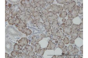 Immunostaining (ISt) image for anti-STT3, Subunit of The Oligosaccharyltransferase Complex, Homolog A (STT3A) (AA 603-701) antibody (ABIN561563)