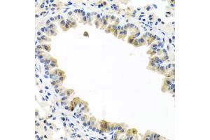 Immunohistochemistry of paraffin-embedded mouse lung using BMP5 antibody (ABIN5974675) at dilution of 1/100 (40x lens). (BMP5 抗体)
