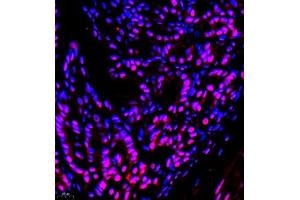 Immunofluorescence (Paraffin-embedded Sections) (IF (p)) image for anti-General Transcription Factor IIIC, Polypeptide 2, beta 110kDa (GTF3C2) antibody (ABIN7074038)