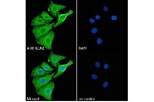 (ABIN570867) Immunofluorescence analysis of paraformaldehyde fixed A549 cells, permeabilized with 0. (IL1R2 抗体  (Internal Region))