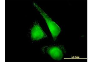 Immunofluorescence (IF) image for anti-Cytochrome P450, Family 2, Subfamily E, Polypeptide 1 (CYP2E1) (AA 1-493) antibody (ABIN514836)