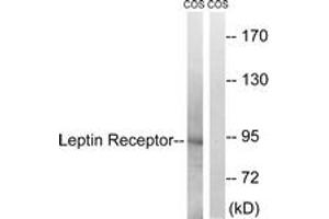 Western blot analysis of extracts from COS7 cells, treated with calyculinA 50ng/ml 30', using Leptin Receptor (Ab-1141) Antibody. (Leptin Receptor 抗体  (AA 1107-1156))