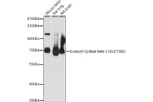 Western blot analysis of extracts of various cell lines, using Guanylyl Cyclase beta 1 (Guanylyl Cyclase beta 1 (GUCY1B3)) antibody (ABIN7267552) at 1:1000 dilution. (GUCY1B3 抗体  (AA 1-250))