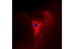 Immunofluorescent analysis of AMPK gamma 2 staining in MCF7 cells. (PRKAG2 抗体  (N-Term))