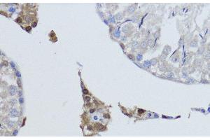 Immunohistochemistry of paraffin-embedded Rat testis using ESRRA Polyclonal Antibody at dilution of 1:200 (40x lens). (ESRRA 抗体)
