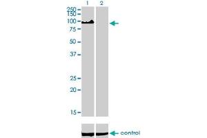 Western blot analysis of ZHX2 over-expressed 293 cell line, cotransfected with ZHX2 Validated Chimera RNAi (Lane 2) or non-transfected control (Lane 1). (ZHX2 抗体  (AA 691-788))