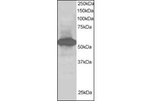 Antibody staining (1 µg/ml) of Human Kidney lysate (RIPA buffer, 30 µg total protein per lane).
