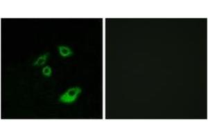 Immunofluorescence analysis of A549 cells, using BCL-2 (Phospho-Thr56) Antibody. (Bcl-2 抗体  (pThr56))