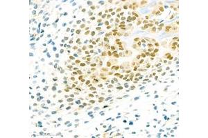 Immunohistochemistry (Paraffin-embedded Sections) (IHC (p)) image for anti-Sp7 Transcription Factor (SP7) antibody (ABIN7075694)