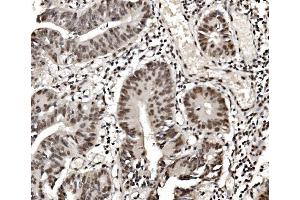 IHC analysis of hnRNP D/AUF1/HNRNPD using anti-hnRNP D/AUF1/HNRNPD antibody (ABIN7602591). (HNRNPD/AUF1 抗体  (AA 88-246))