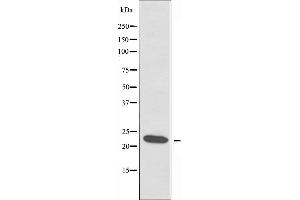 Western blot analysis of extracts from COLO cells using RPL18 antibody. (RPL18 抗体)