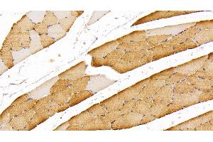 Immunohistochemistry (IHC) image for anti-Myoglobin (MB) (AA 1-154) antibody (ABIN7429601)