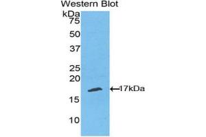 Western blot analysis of the recombinant protein. (TNFRSF19 抗体  (AA 222-363))