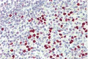 Immunohistochemistry (IHC) image for anti-Peptidyl Arginine Deiminase, Type IV (PADI4) (N-Term) antibody (ABIN185308)