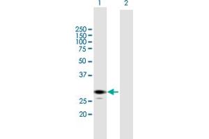 Western Blot analysis of ECHS1 expression in transfected 293T cell line by ECHS1 MaxPab polyclonal antibody.