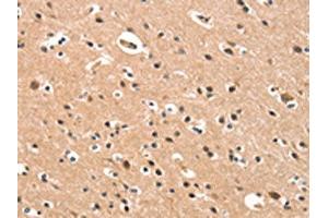 The image on the left is immunohistochemistry of paraffin-embedded Human brain tissue using ABIN7190422(CYP46A1 Antibody) at dilution 1/15, on the right is treated with synthetic peptide. (CYP46A1 抗体)