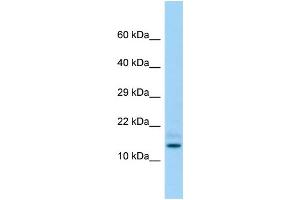 Host: Rabbit Target Name: Hddc3 Sample Type: Rat Testis lysates Antibody Dilution: 1. (HDDC3 抗体  (Middle Region))
