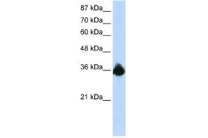 PTBP2 antibody used at 1. (PTBP2 抗体  (N-Term))