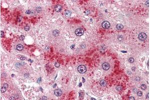 ABIN185639 (4µg/ml) staining of paraffin embedded Human Liver. (Leptin Receptor 抗体  (Internal Region))