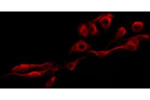 ABIN6267300 staining HepG2 by IF/ICC. (Integrin beta 3 抗体  (pTyr785))