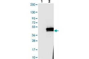 Western blot analysis of Lane 1: Negative control (vector only transfected HEK293T lysate). (ANKRD2 抗体)