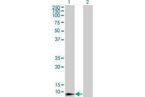 Western Blot analysis of DEFB4 expression in transfected 293T cell line by DEFB4 monoclonal antibody (M01), clone 4C4.