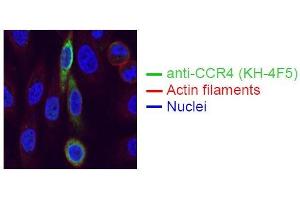 Immunofluorescence (IF) image for anti-Chemokine (C-C Motif) Receptor 4 (CCR4) antibody (ABIN179723)