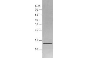 Western Blotting (WB) image for Interleukin 7 (IL7) (AA 26-154) protein (His-IF2DI Tag) (ABIN7123615) (IL-7 Protein (AA 26-154) (His-IF2DI Tag))