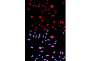 Immunofluorescence (IF) image for anti-Mdm2, p53 E3 Ubiquitin Protein Ligase Homolog (Mouse) (MDM2) (pSer166) antibody (ABIN1870422) (MDM2 抗体  (pSer166))