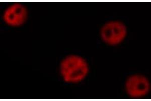 ABIN6266664 staining Hela by IF/ICC. (TOP2B 抗体  (N-Term))