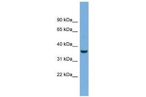 Crystallin Mu antibody used at 1 ug/ml to detect target protein. (CRYM 抗体  (N-Term))