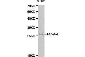 Western blot analysis of extracts of K562 cells tissue, using SOCS3 antibody. (SOCS3 抗体  (C-Term))