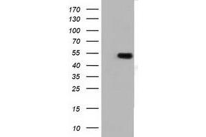 Western Blotting (WB) image for anti-Tubulin, alpha 3e (TUBA3E) antibody (ABIN1501557) (TUBA3E 抗体)