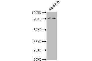 Western Blot Positive WB detected in: SH-SY5Y whole cell lysate All lanes: GPLD1 antibody at 1:2000 Secondary Goat polyclonal to rabbit IgG at 1/50000 dilution Predicted band size: 93, 20 kDa Observed band size: 93 kDa (GPLD1 抗体  (AA 310-565))