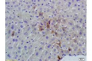 Formalin-fixed and paraffin embedded mouse liver labeled with Rabbit Anti phospho-GCN2 (Thr667) Polyclonal Antibody, Unconjugated (ABIN684958) at 1:200 followed by conjugation to the secondary antibody and DAB staining (GCN2 抗体  (pThr667))