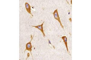 Paraformaldehyde-fixed, paraffin embedded human brain tissue, Antigen retrieval by boiling in sodium citrate buffer (pH6. (BCAP31 抗体)